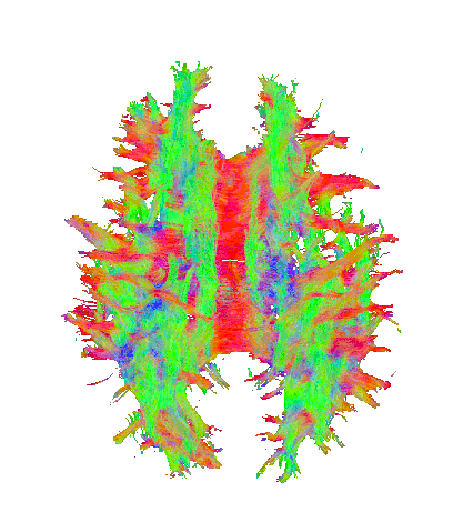DeepSTI: Towards Tensor Reconstruction using Fewer Orientations in Susceptibility Tensor Imaging