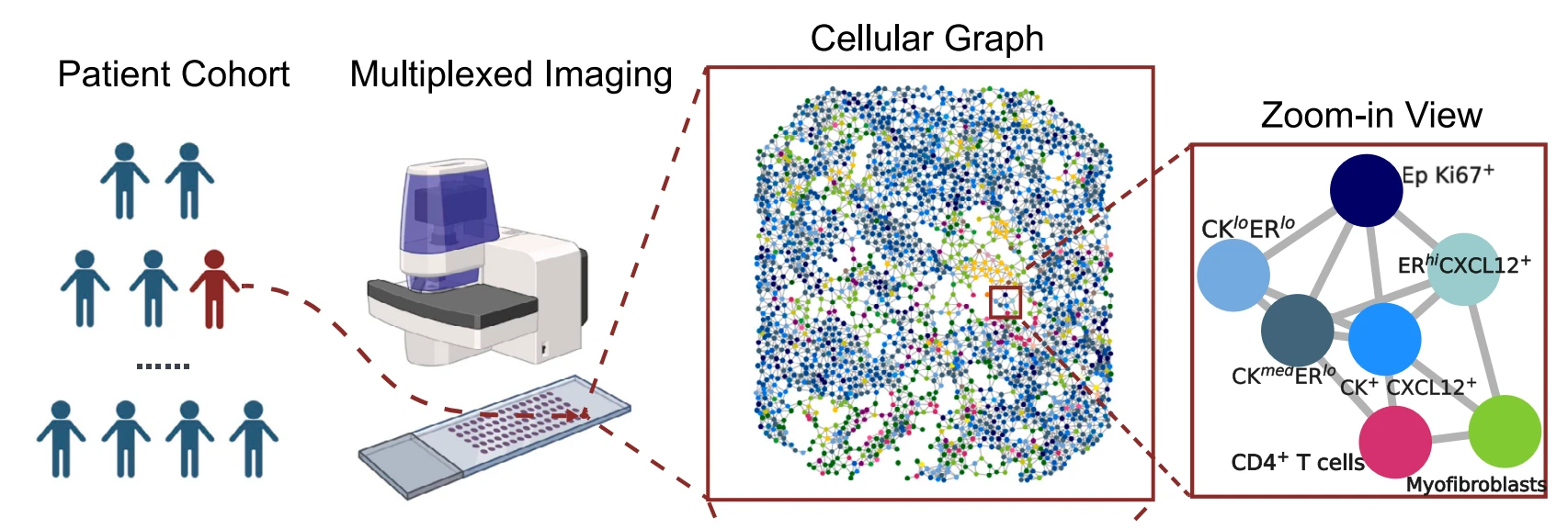 Bi-level Graph Learning Unveils Prognosis-Relevant Tumor Microenvironment Patterns from Breast Multiplexed Digital Pathology